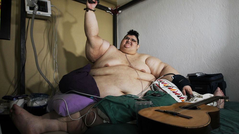 El hombre más obeso del mundo quiere adelgazar